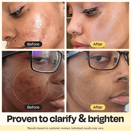 Maschera all'argilla con vitamina C
