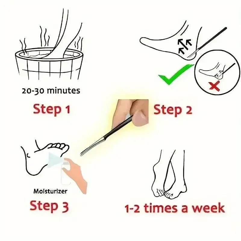 1 pz Strumenti per Pedicure Kit Professionale in Acciaio Inossidabile Lima per Piedi Rimuovi Pelle Morta Raschietto per Piedi Strumento per la Cura dei Piedi Nuovo