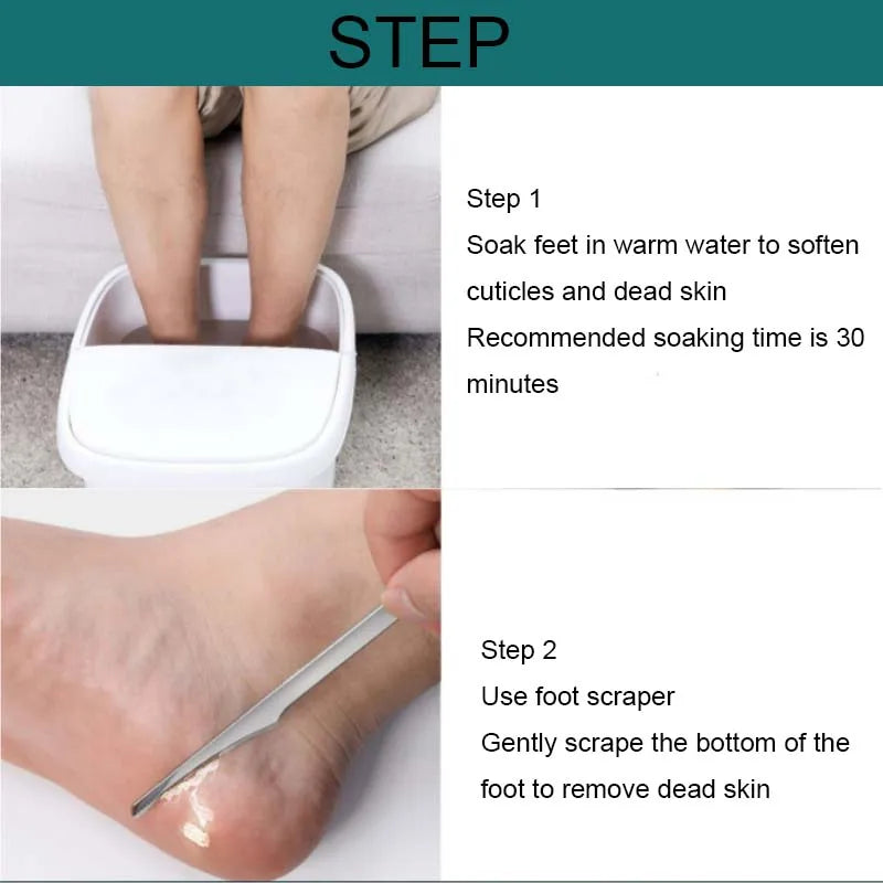 1 pz Strumenti per Manicure Pedicure Rasoio per Unghie dei Piedi Kit Coltelli per Pedicure Piedi Rimuovi Calli Lima per Calli Strumenti per la Cura dei Piedi Morti